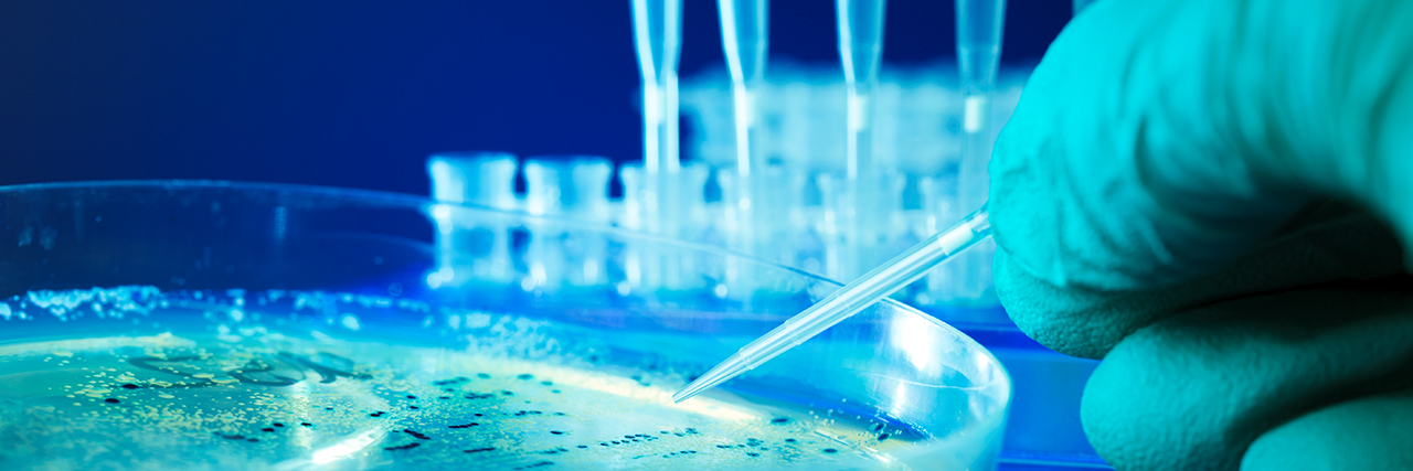 Research close-up photo of a petri dish with bacterial colonies sampling in Auburn University lab.